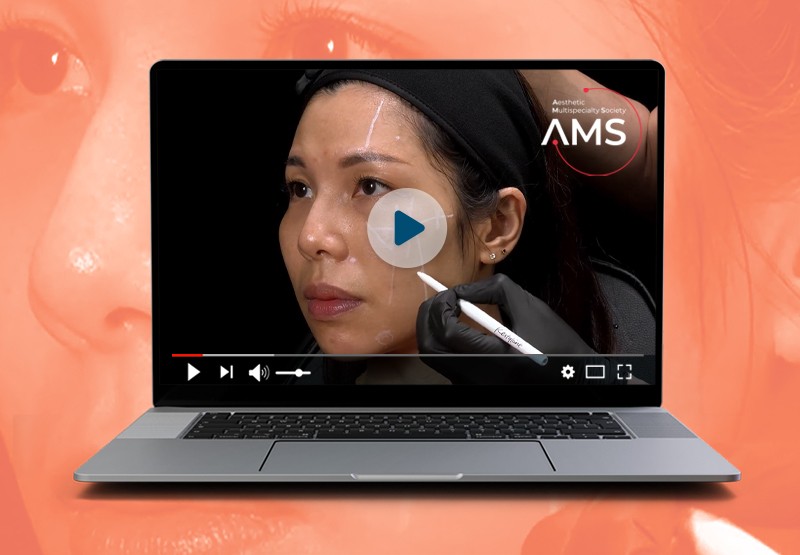AMWC Asia TDAC - Replay on AMS
